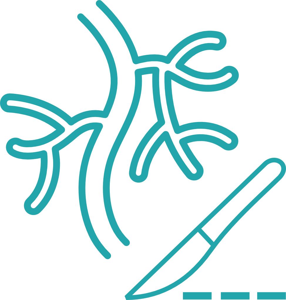 Top Vascular and Endovascular Surgery in Hyderabad