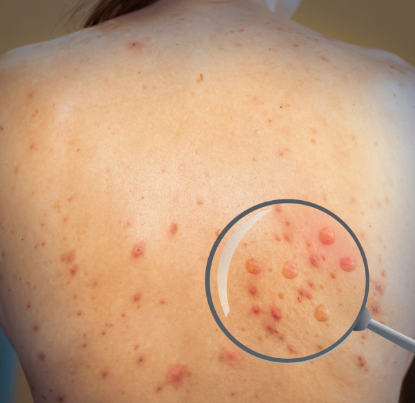 conditions-treated-infectious-disease.png