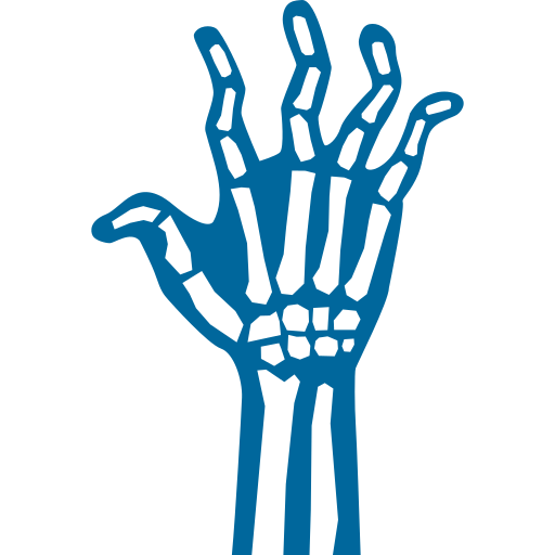 Arthritis